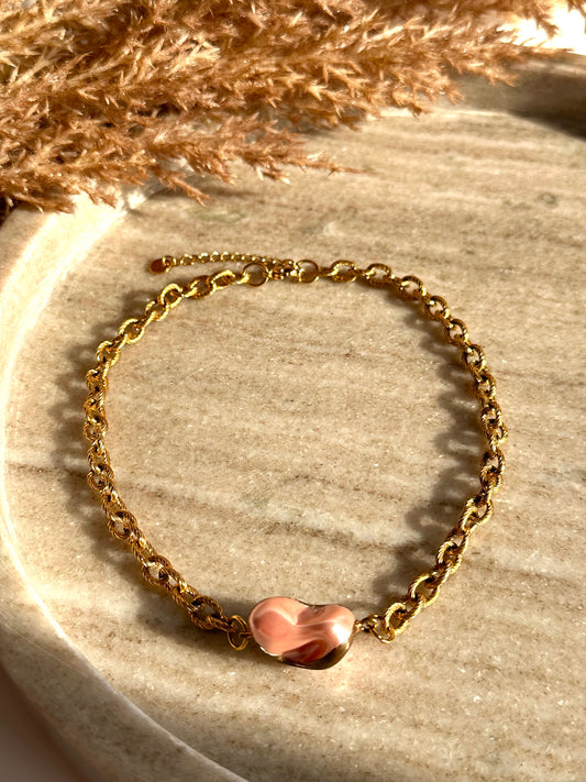 Monika Choker Necklace